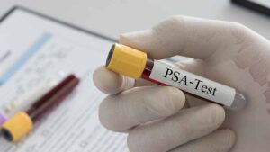 I medici di base spesso costituiscono una barriera per impedire agli uomini di colore di sottoporsi al test per il cancro alla prostata