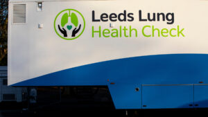 Lo screening mobile del cancro al polmone dell’NHS ha rilevato più di 5.000 casi