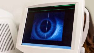 Svolta nel diabete grazie all’intelligenza artificiale, mentre l’NHS lancia un programma di screening oculistico