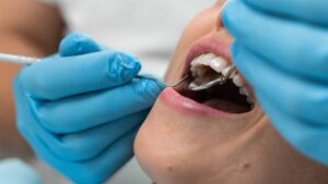 Persone che non possono accedere all'odontoiatria a causa degli aumenti dei prezzi "allettanti".